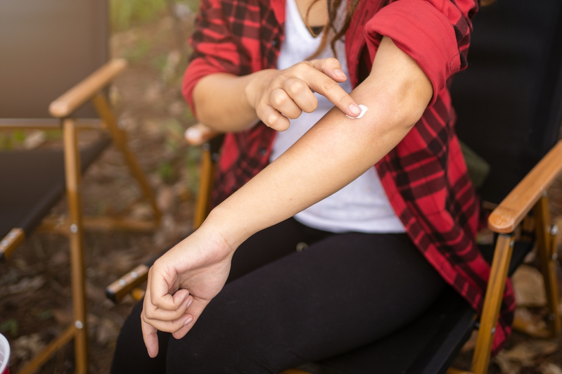 woman putting hydrocortisone cream on bug bite